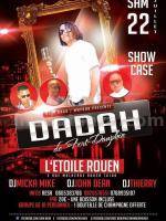 Dadah De Fort-Dauphin en show case Etoile Rouen