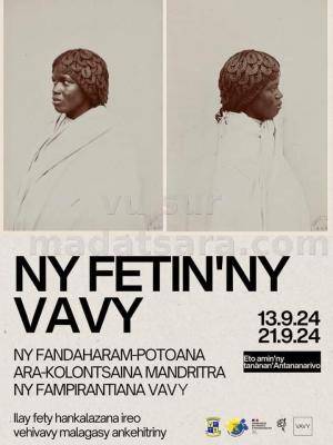 Fetin'ny vavy