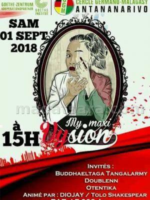 My maxi vision en live CGM Analakely